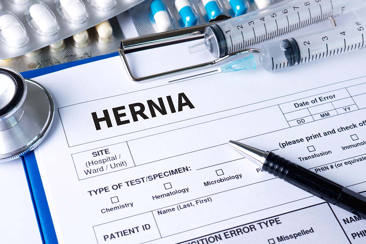 Hernia Mesh Lawsuit